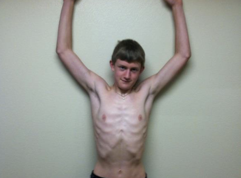 <p>The patient places the forearms on a wall in neutral with elbows flexed and the shoulder horizontally abducted and externally rotated. The patient is then instructed to slide the forearms up and down the wall and lower with control. The patient should stop elevation if the forearms start to lose contact with the wall</p><p>Note: Shoulder mobility can be a problem. To make it harder perform in prone to have scapular retraction against gravity. </p>