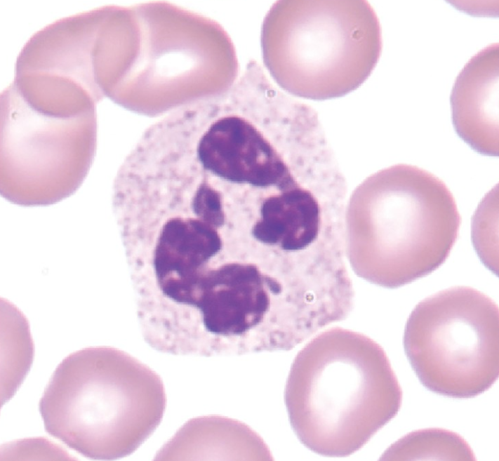 <p>Which WBC is this?</p>