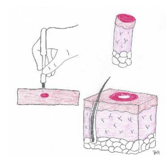 <p>Pigmented lesions</p><p>Inflammatory lesions</p><p>Chronic skin disorders</p><p>Cutaneous neoplasms </p>