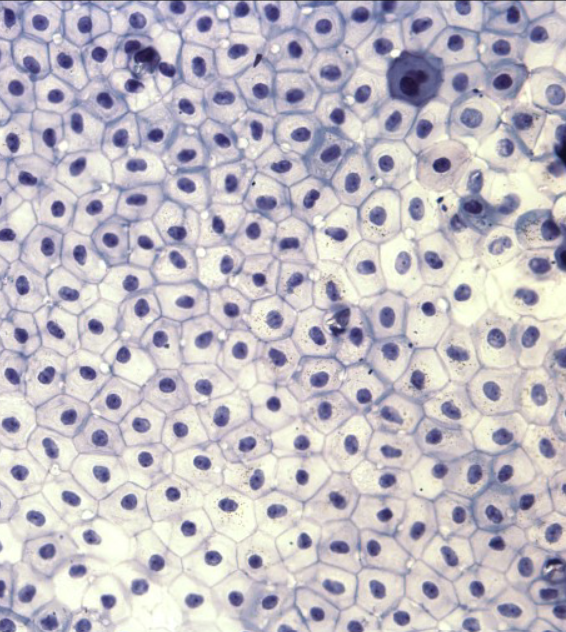 <p>identify this tissue</p>