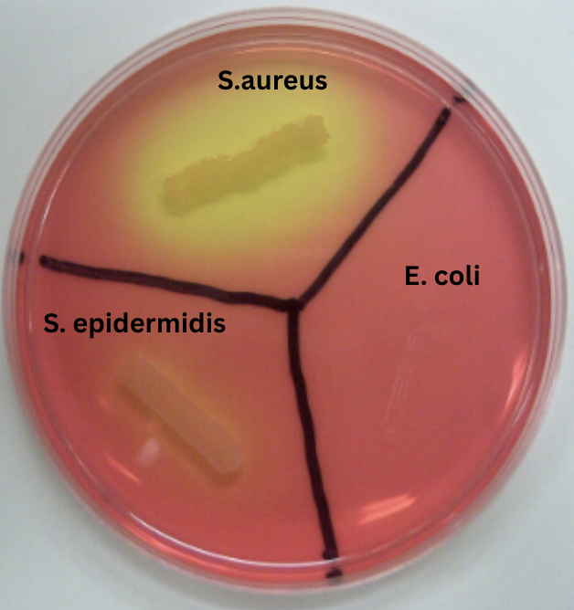 <p>A) <strong>Mannitol fermentation</strong> that produces acid (pH <6.8), hence the yellow halo</p><p>B) <strong>Growth</strong> on the agar, but <strong>does not ferment mannitol</strong></p><p>C) <strong>No growth/fermentation</strong></p>
