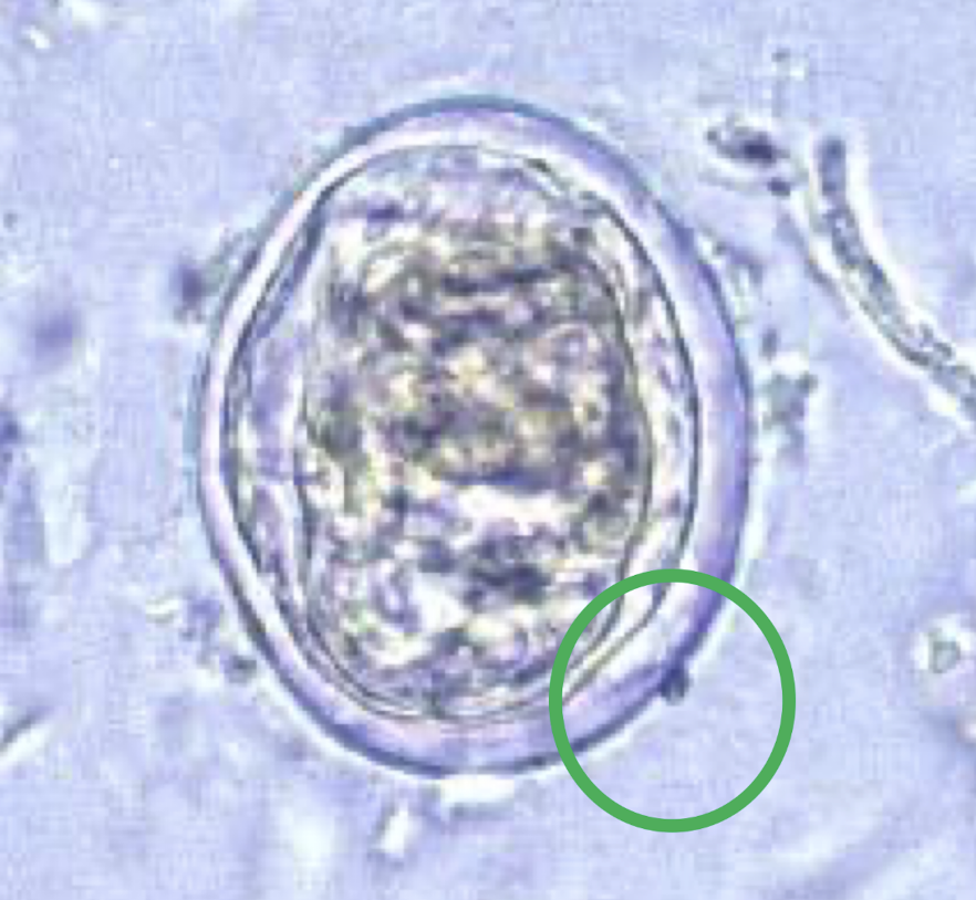 <p>What parasite is this?</p>