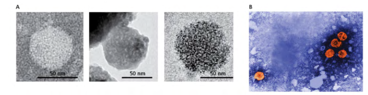 <p>Cancer: a collection of many different diseases that are all characterized by the abnormal proliferation of malignant cells that are invasive and ultimately kill the affected animal</p><p>- A small subset of viruses is known to be oncogenic (cancer-causing) in humans</p><p>- Hepatocellular carcinoma is caused by persistent lytic viral infections</p><p>.</p><p>HCV and HBV cause hepatocellular carcinoma. (A) Electron micrograph of a hepatitis C virus (HCV), a spherical enveloped (+) RNA virus. (B) Digitally colorized electron micrograph of the reverse-transcribing, spherically enveloped hepatitis B virus (HBV), which is about 42 nm in diameter.</p><p>.</p><p>- Hepatitis B and C are what you think about when you think about cancer</p>