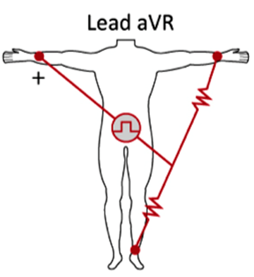 <p>aVR</p>