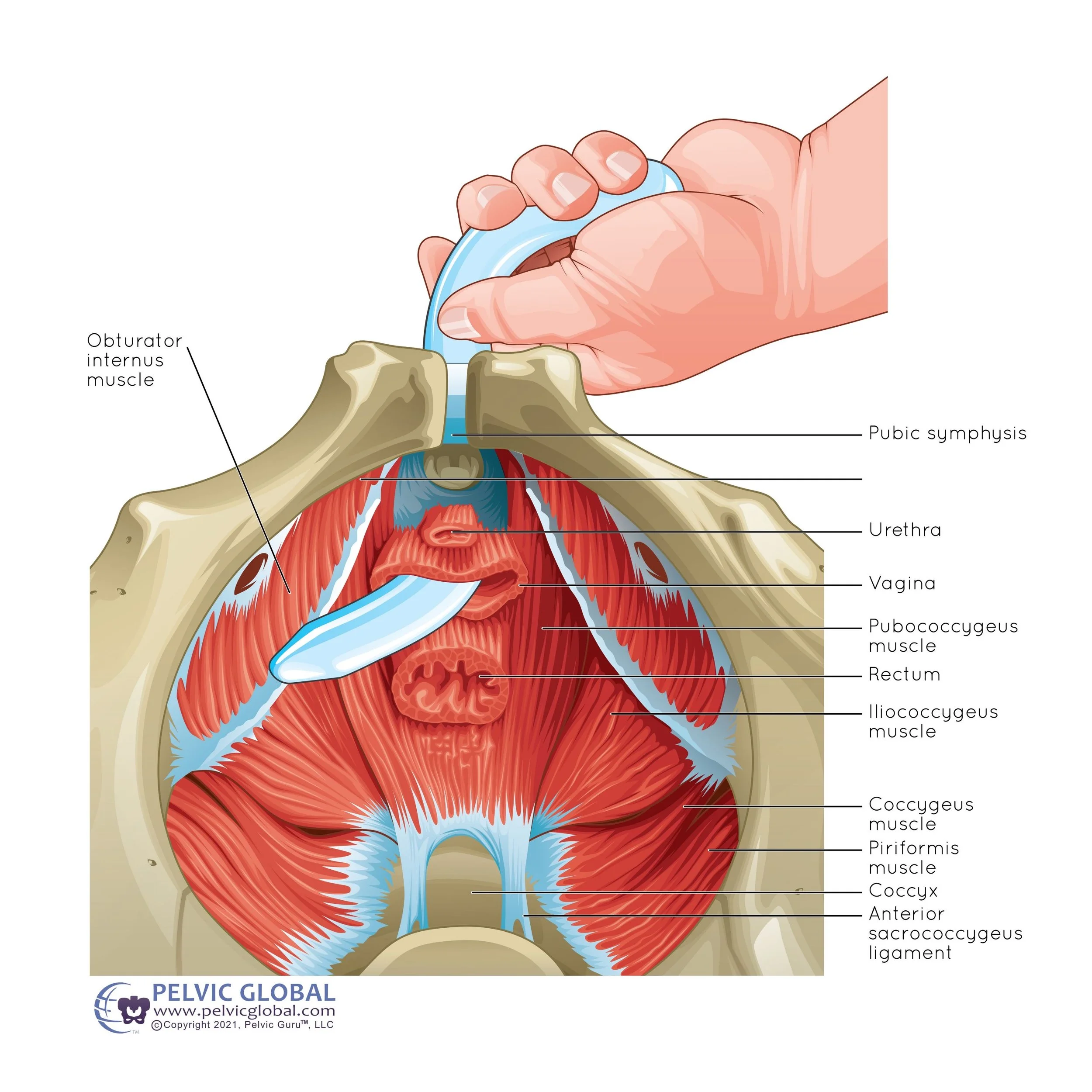 <p>internal obturator internus release</p>