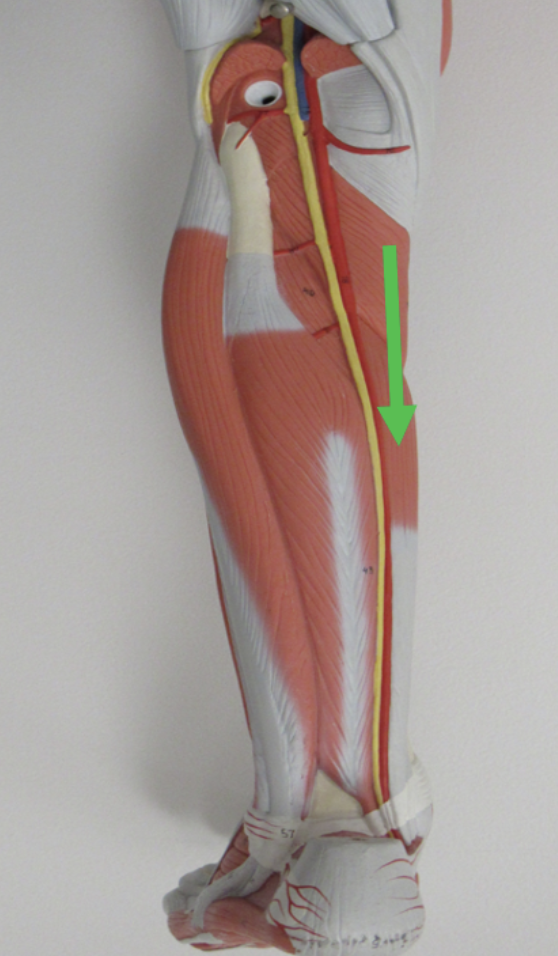 <p>Identify the muscle indicated by the pointer.</p>