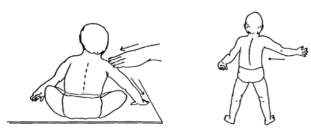 <ul><li><p>equilibrium reaction</p></li><li><p>allows infants to maintain their position in space when their body is acted on by a displacing force (such as being pushed)</p></li><li><p>this is a more advanced reaction so a young infant would not have developed this yet</p></li></ul><p></p>