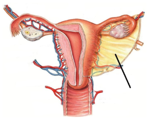 <p><span style="line-height: 17.375px;">Identify the ligament&nbsp;</span></p>