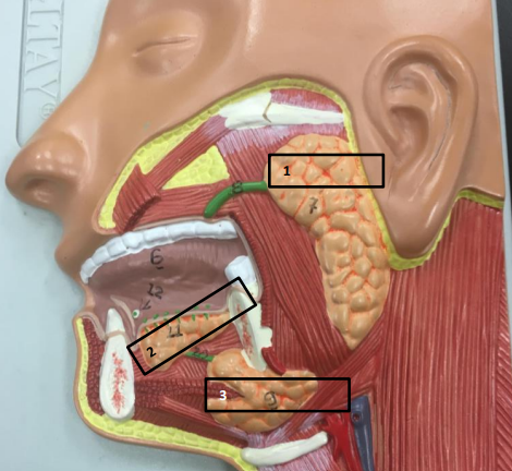 <p>Label this image.</p>