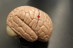 <p>depression</p>