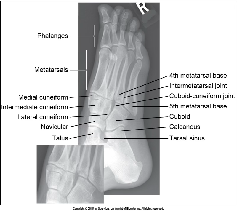 <p>AP oblique foot</p>