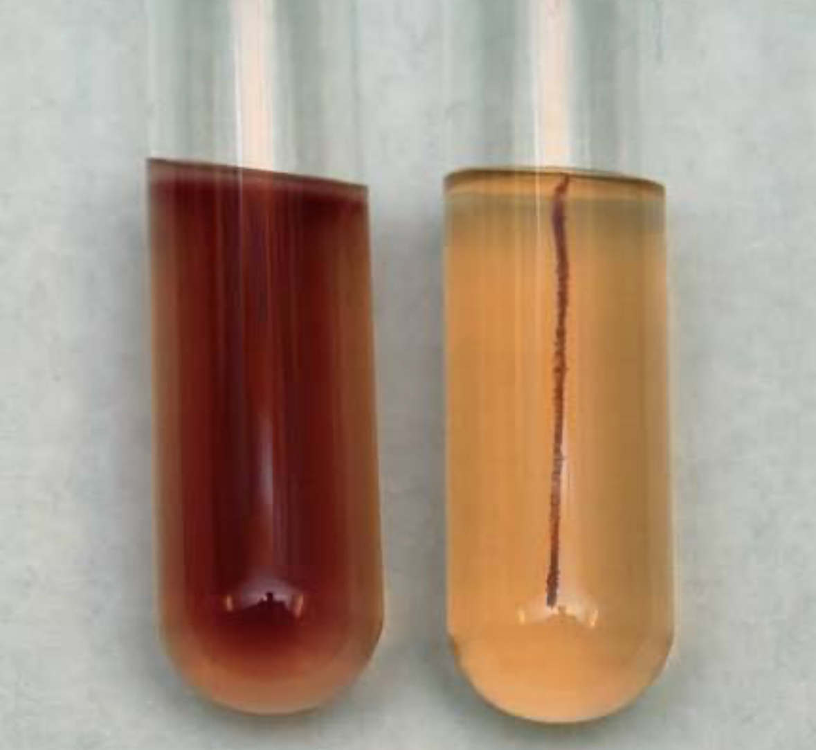 <p>Which tube indicates a positive result for motility? </p>