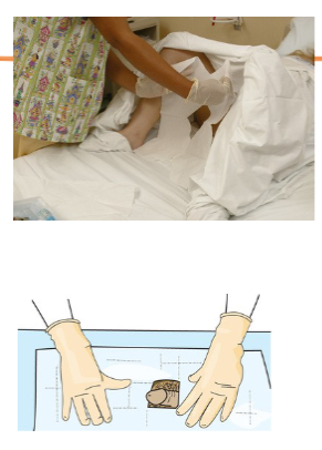 <p>female: apply fenestrated drape over perineum, exposing labia</p><p>male: apply fenestrated drape over thighs and drape it over penis</p>