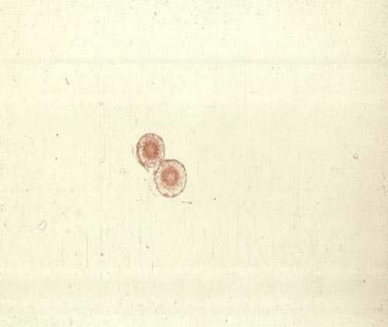 <ul><li><p>Typically seen in acidic urine.</p></li><li><p>Resemble a wheel or a “pin cushion”.</p></li><li><p>Can be seen in animals with liver disease.</p></li></ul><p></p>