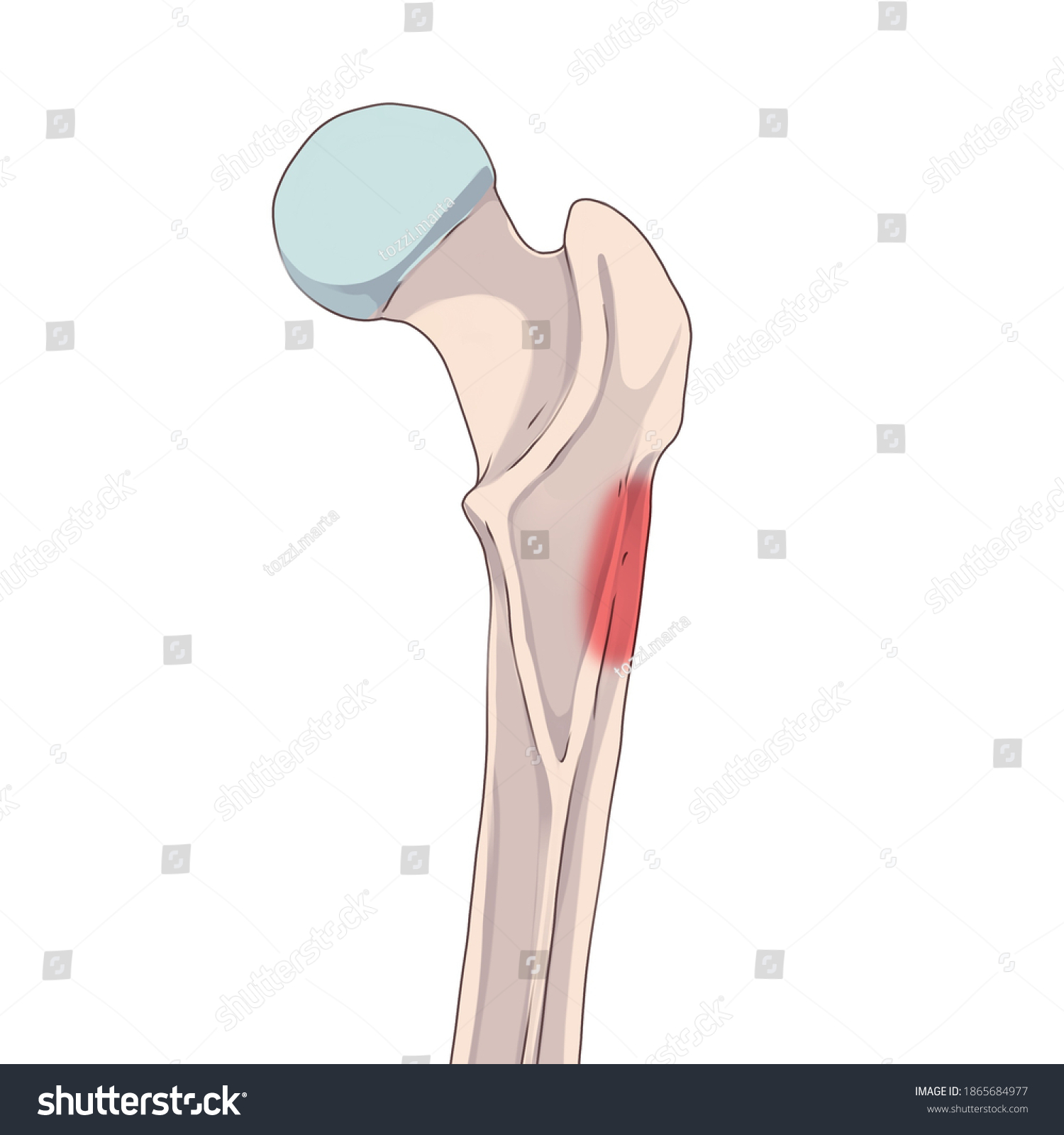 term image
