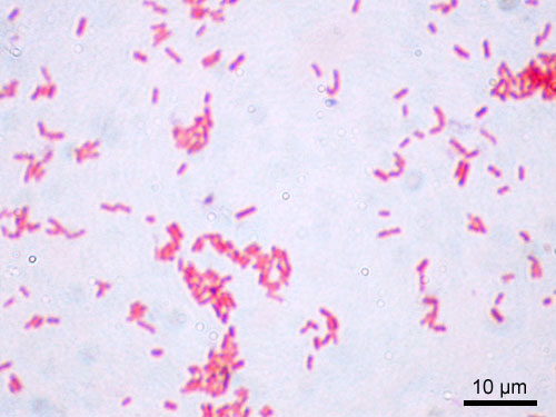 <ul><li><p><span><strong>Shape & Size:</strong> Short bacilli (rods) typically measuring \(0.5 - 0.8 \,\mu\text{m}\) in width and \(0.9 - 2.0 \,\mu\text{m}\) in length.</span></p></li><li><p><span><strong>Gram Staining:</strong> Gram-negative; due to a thin peptidoglycan layer, they do not retain crystal violet and stain pink/red with safranin.</span></p></li><li><p><span><strong>Flagella & Motility:</strong> Motile using peritrichous flagella (flagella distributed over the entire cell surface).</span></p></li><li><p><span><strong>Spore Formation:</strong> Non-spore-forming.</span></p></li><li><p><span><strong>Capsule:</strong> Generally non-encapsulated (or has a very poorly defined capsule), though this can vary across specific clinical isolates</span></p></li></ul><p></p>