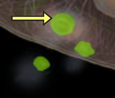<p>Gen cell</p>