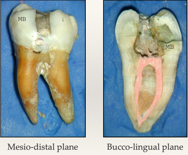 <p>Which direction do mandibular molars tend to curve?</p>