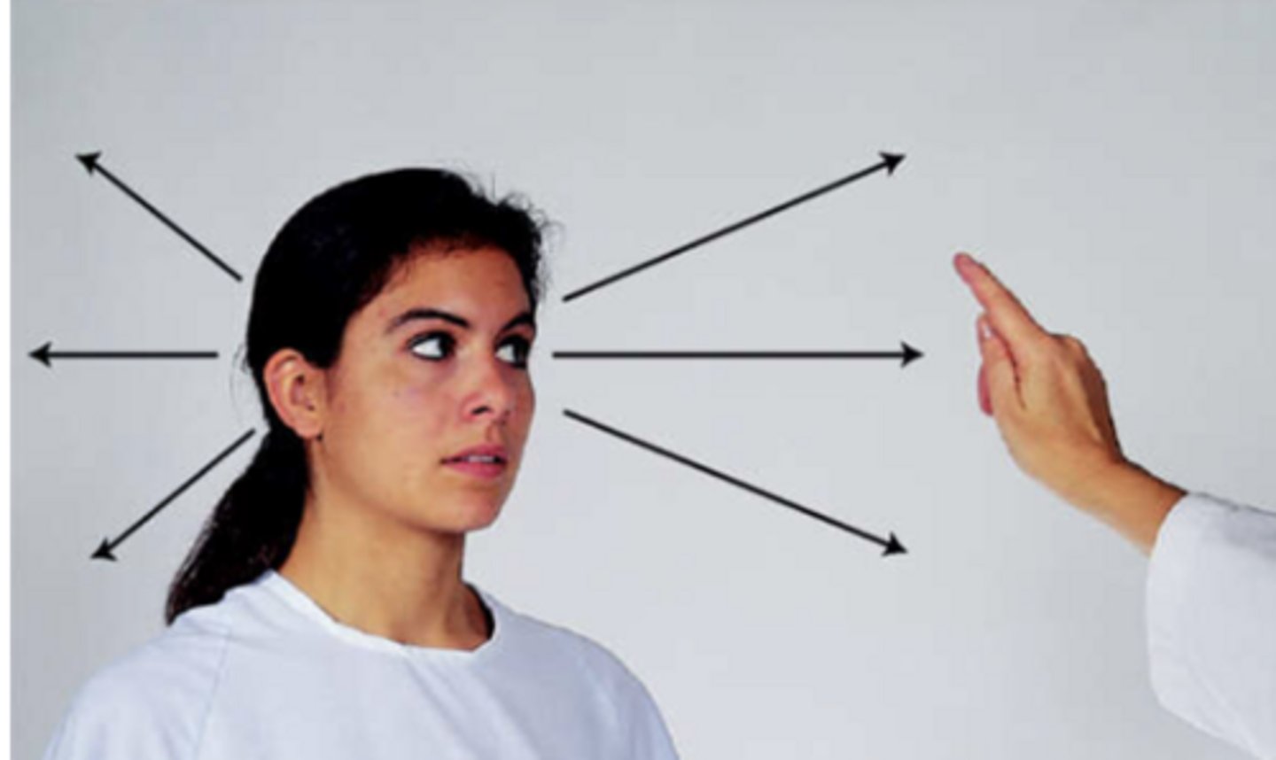 <p>Abducens</p><p>6 Cardinal Fields (down and in eye movement)</p>