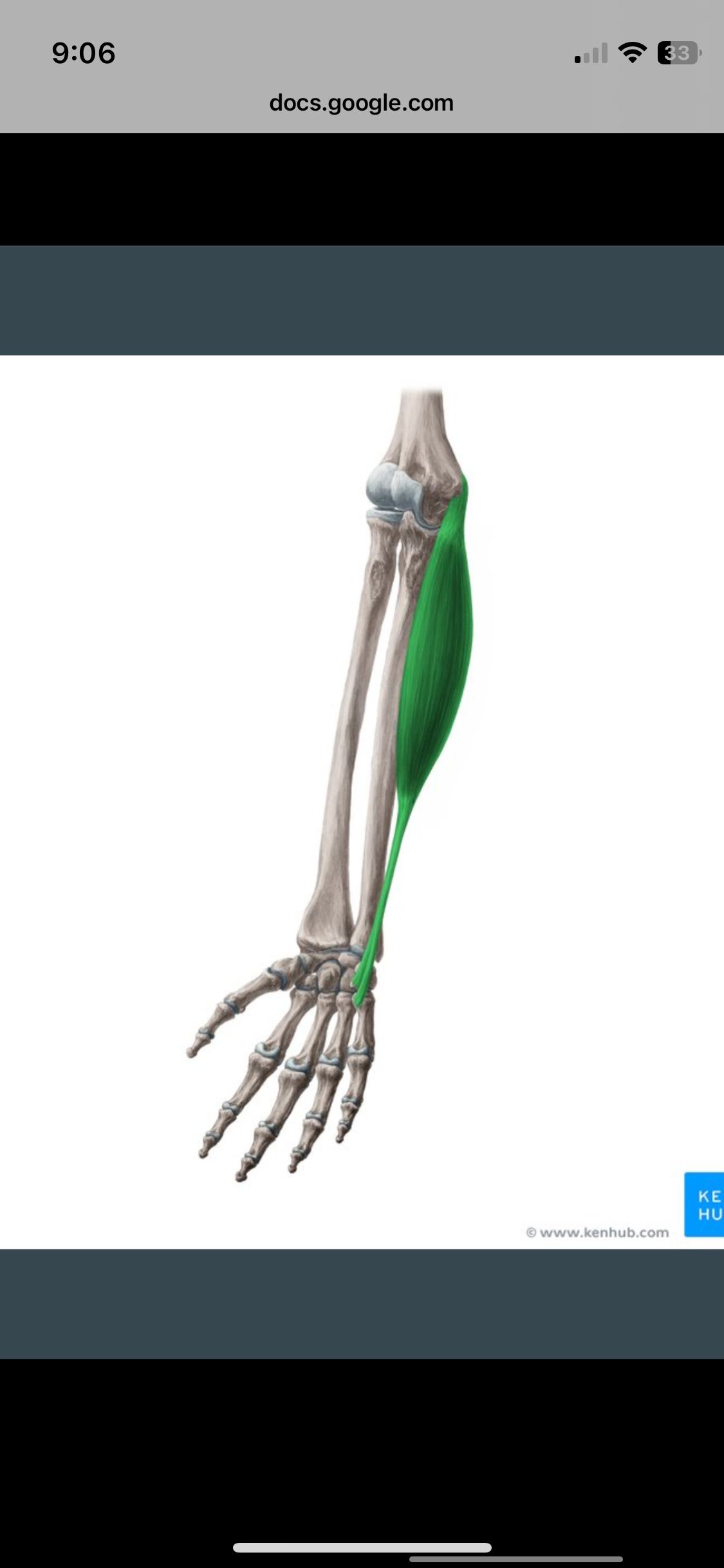<p>Flexor Carpi Ulnaris</p>