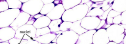 <p>• Empty-looking cells with nucleus pressed against cell membrane</p><p>• Adipocytes are fat cells filled with triglycerides</p><p>• Energy storage, cushions organs</p><p>• Hypodermis (subcutaneous layer of skin: what we typically call</p><p>our fat) and around the heart and kidneys</p>