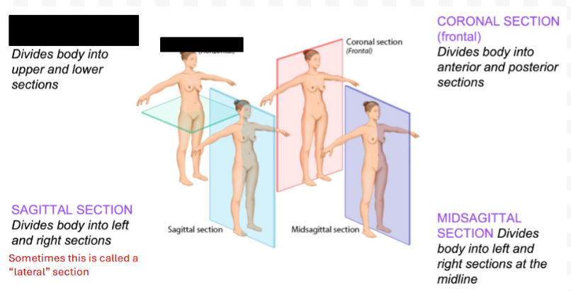 <p>Identify the anatomical plane/section shown.</p>
