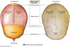 <p>The suture between the two parietal bones.</p>