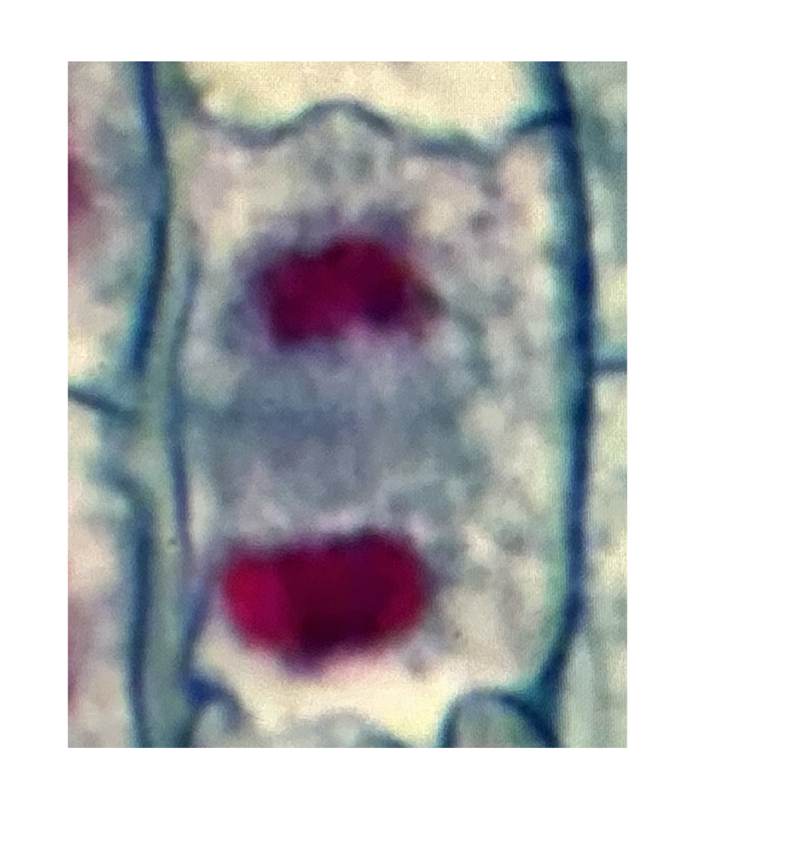 <p>What phase of mitosis is this?</p>