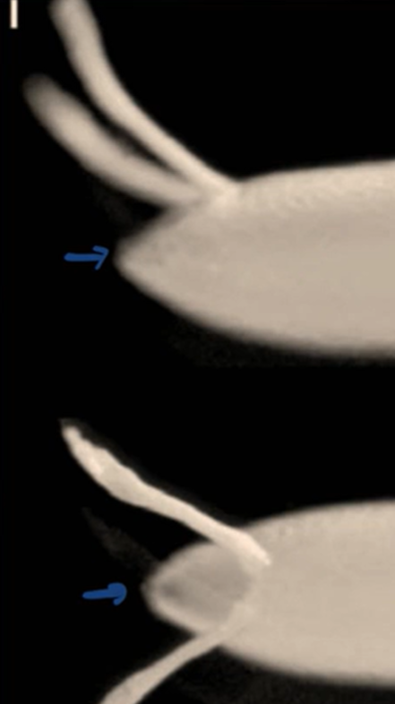 <p>A small opening at the anterior end of the chorion that allows sperm to penetrate</p><ul><li><p>Once sperm has penetrated into the micropyle, it can stay alive for an extremely long time</p></li></ul><p></p>