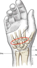 <p>What is this joint?</p>