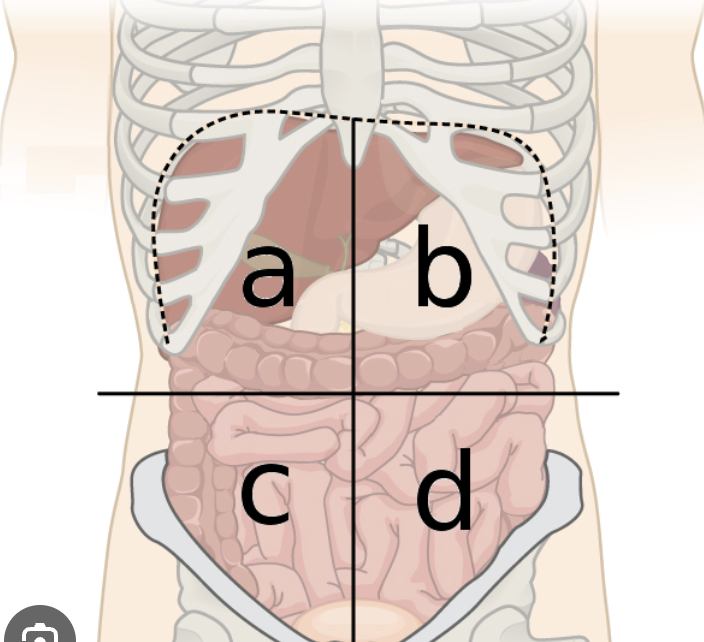 <p>A</p>