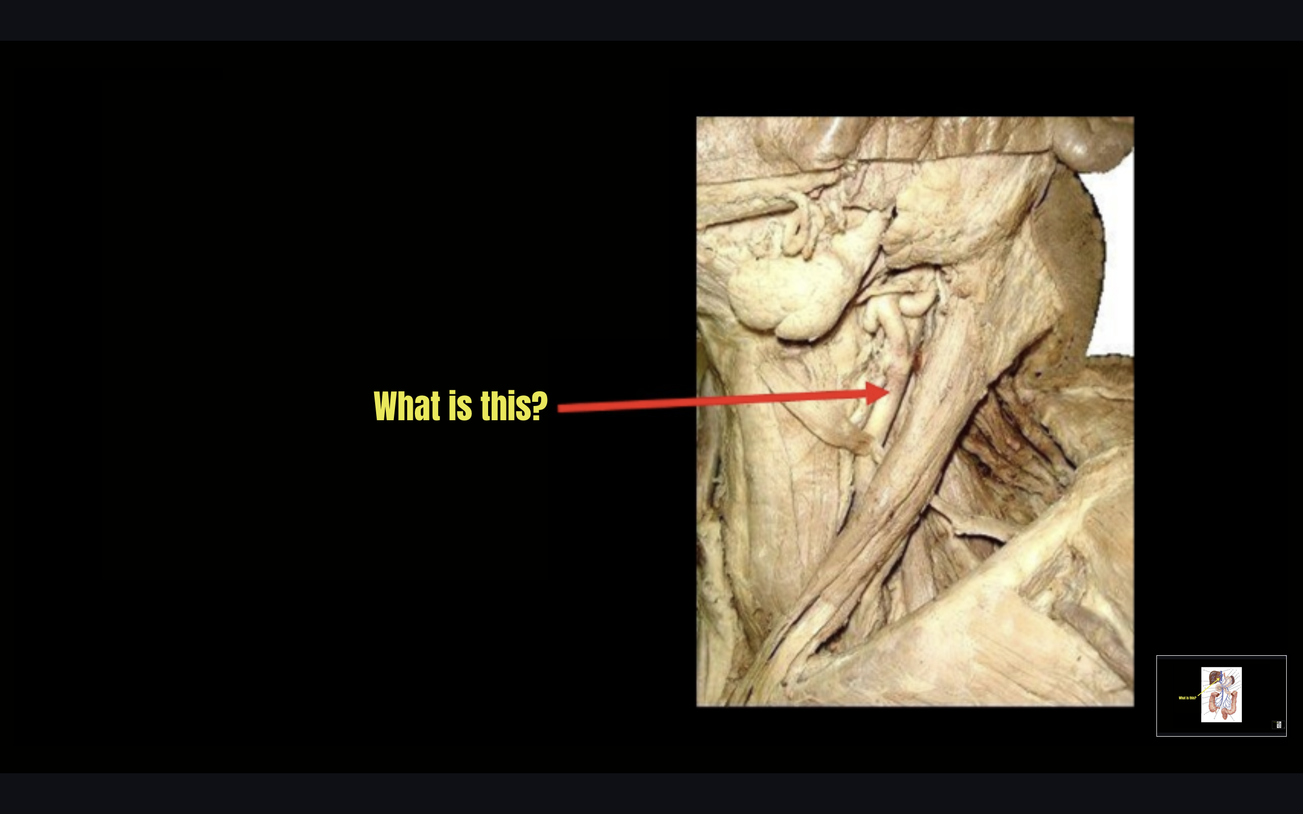 term image