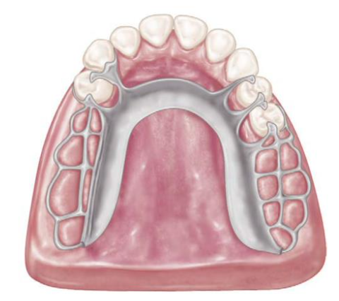 <p>U-shaped (horseshoe)</p>