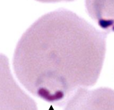 <p>parasite is closely opposed to the edge of the erythrocyte</p><p>usually appears flattened against the membrane </p>