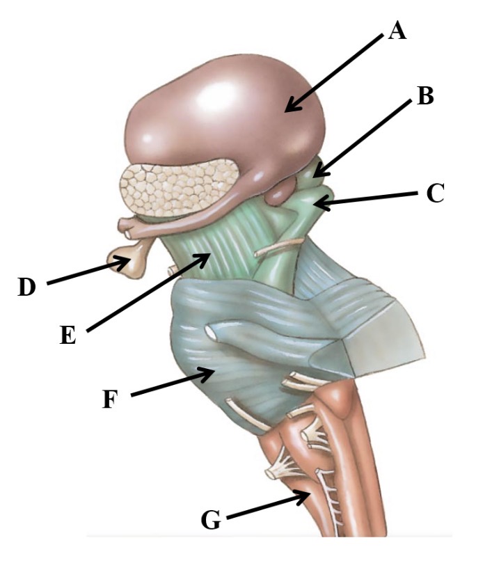 <p>A</p>