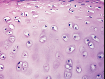 <ul><li><p>amorphous and firm matrix</p></li><li><p>collagen fibers </p></li><li><p>found in joints, repiratory tubes, and embryo</p></li><li><p><strong>FUNCTIONS </strong>→ support and cushioning</p></li></ul><p></p>