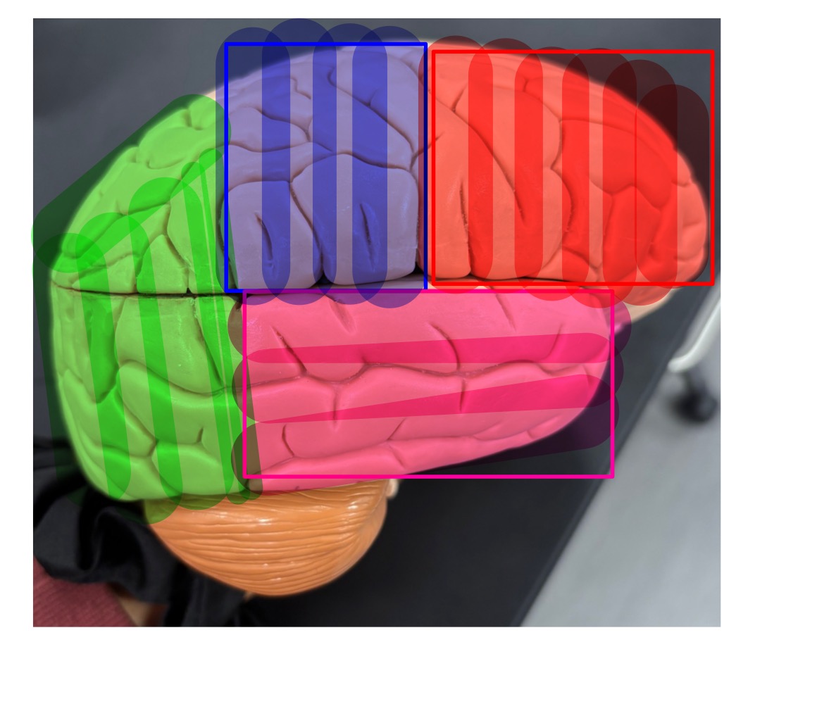 <p>name the lobe highlighted in green </p>