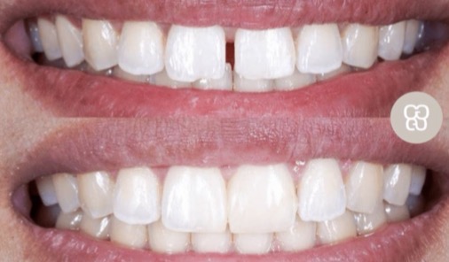 <p>What dental specialty is being displayed here?</p>