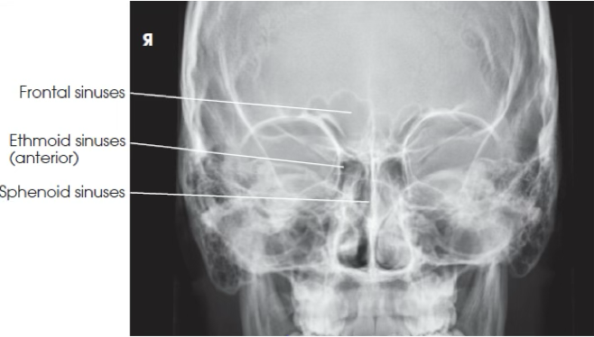 <p>What view is this?</p>