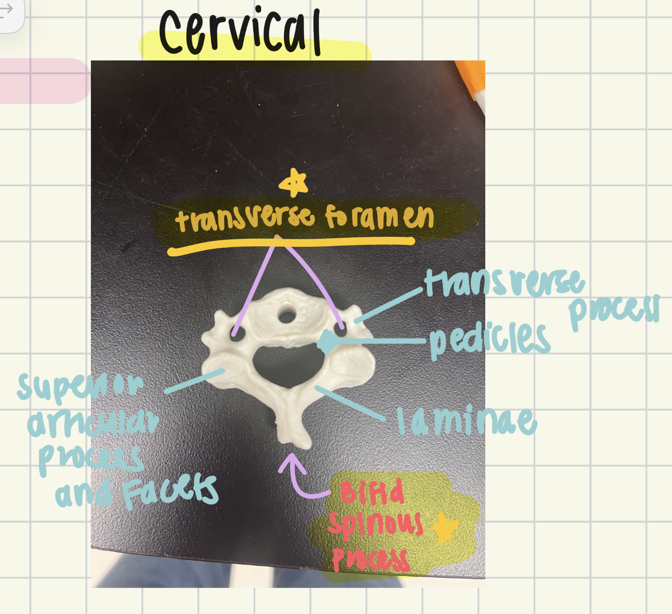 <p>Cervical; transverse foramen and bifid spinous process</p>