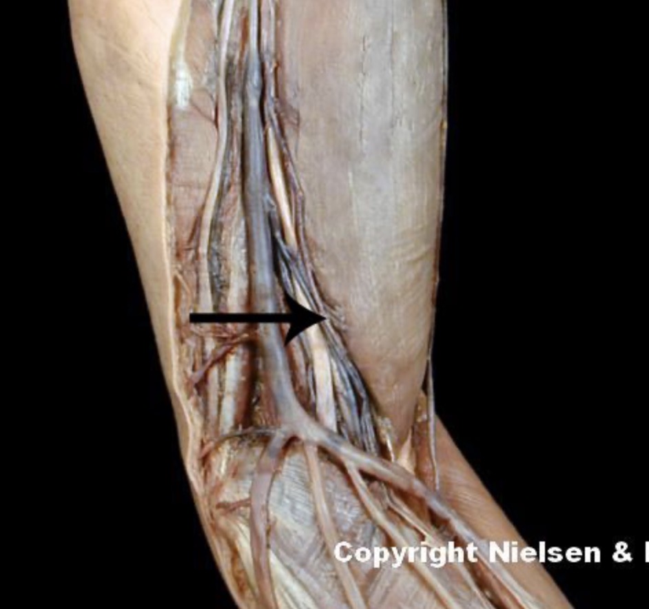 <p>The indicated vessel is the _ (anteromedial view of superficial veins of arm/forearm)</p>