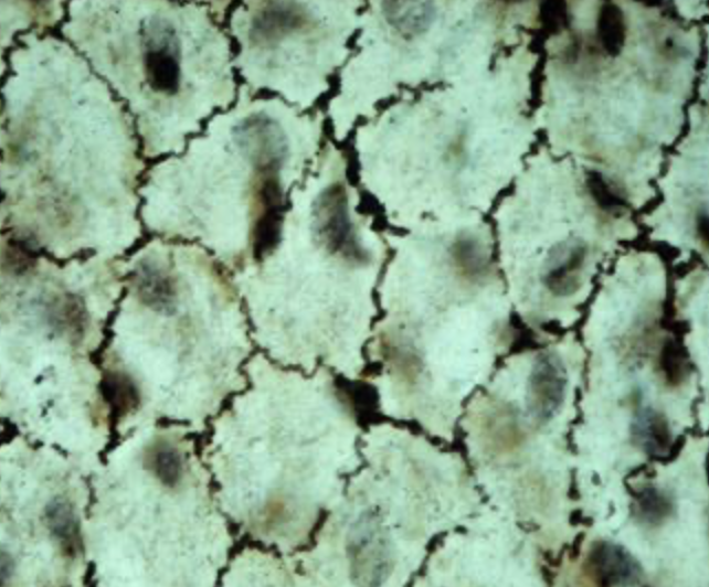 <p>tissue type</p>