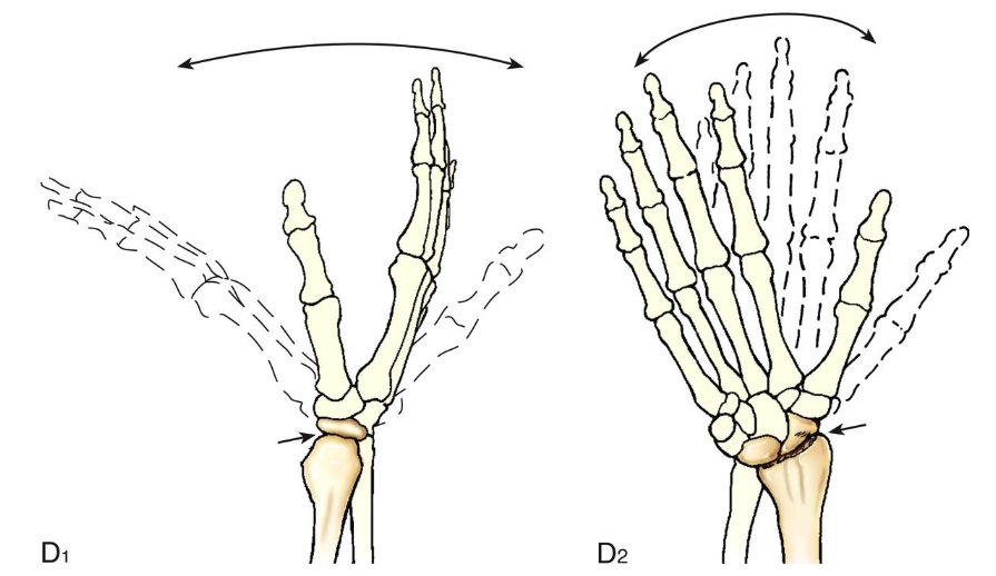 <p>Ellipsoid joint</p>