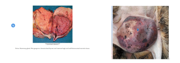 <ul><li><p>When already necrotic tissue becomes infected with bacteria.</p></li><li><p>The affected area becomes dark, foul-smelling, and wet.</p></li></ul><p></p>