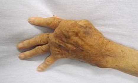 <p>What is the pathology shown?</p>