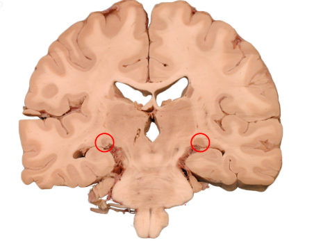 <p>A structure in the thalamus that is the relay/processing center for visual information.</p>