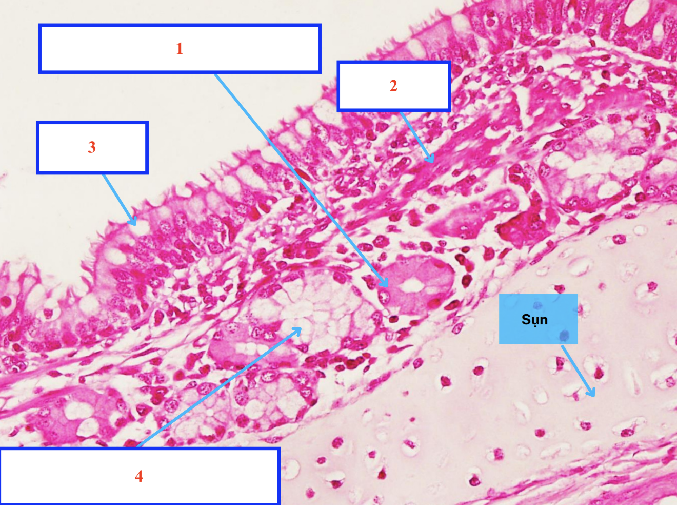 <ol><li><p>Cấu trúc gì ?</p></li><li><p>Cấu trúc gì ?</p></li><li><p>Tế bào gì ?</p></li><li><p>Cấu trúc gì ?</p></li></ol><p></p>