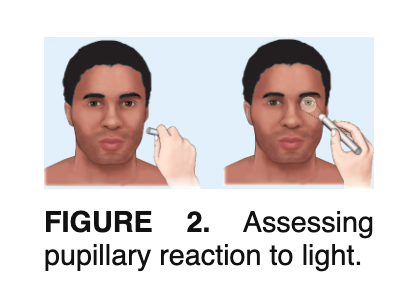 <p>What cranial nerve is being tested when you test for pupillary response to light (consensual reflex)?</p>
