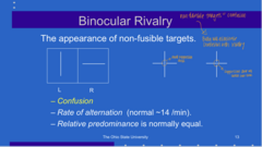 <p>________ is normally equal between the 2 eyes</p>