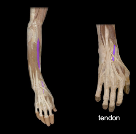 <p>What the highlighted structure is acting on the <strong><mark data-color="#ffdb9c" style="background-color: rgb(255, 219, 156); color: inherit;">Wrist and Hands</mark>.</strong> What muscle is this called?</p>
